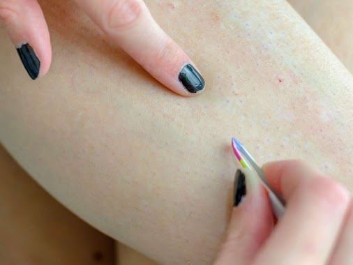 6 Tips On How To shave Your legs Smoothly And Without Ingrown Hair